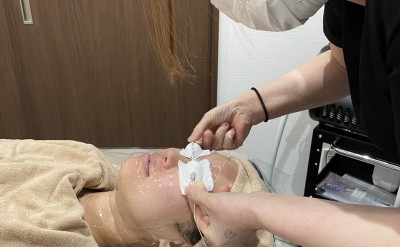 レディス顔脱毛