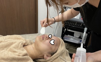 レディス顔脱毛